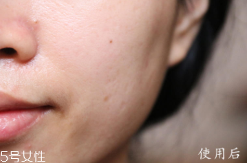 悅木之源和伊麗莎白雅頓哪個好？兩款精華大比拼