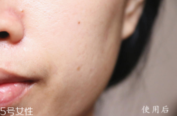 悅木之源和伊麗莎白雅頓哪個好？兩款精華大比拼