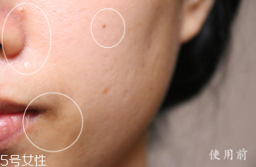 悅木之源和伊麗莎白雅頓哪個好？兩款精華大比拼