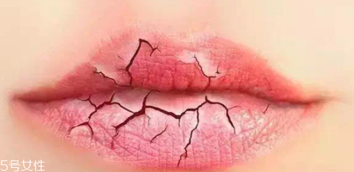 唇紋深適合什么口紅？別用啞光口紅