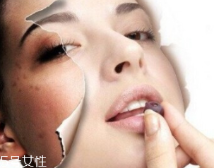 春季如何預防皮膚過敏？選擇敏感肌專用護膚品