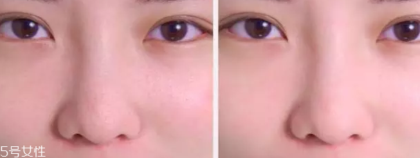 草莓鼻用什么產(chǎn)品最有效？4款產(chǎn)品讓鼻頭亮麗潔凈