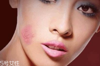 紅血絲用哪種護(hù)膚品？6款大牌全面對(duì)抗紅血絲