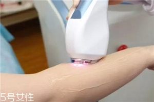 脫毛儀可以脫發(fā)際線嗎？脫了還會再長