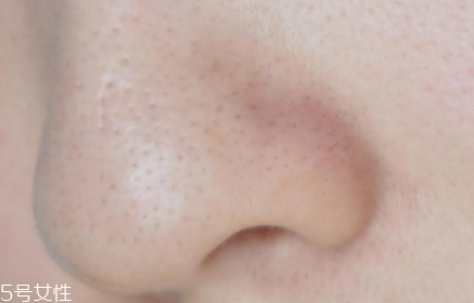 薇姿魔幻水怎么樣？薇姿水光煥亮角質(zhì)調(diào)理液好用嗎？