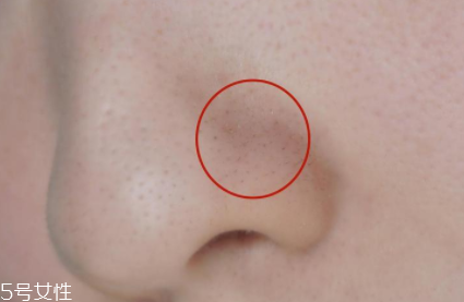 薇姿魔幻水怎么樣？薇姿水光煥亮角質(zhì)調(diào)理液好用嗎？