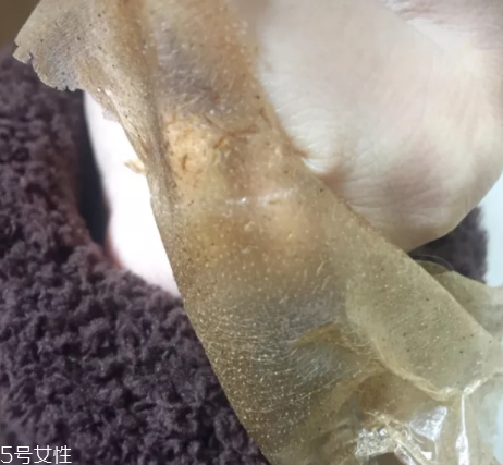 雪花秀撕拉面膜怎么撕出黑頭？這么做才能去黑頭