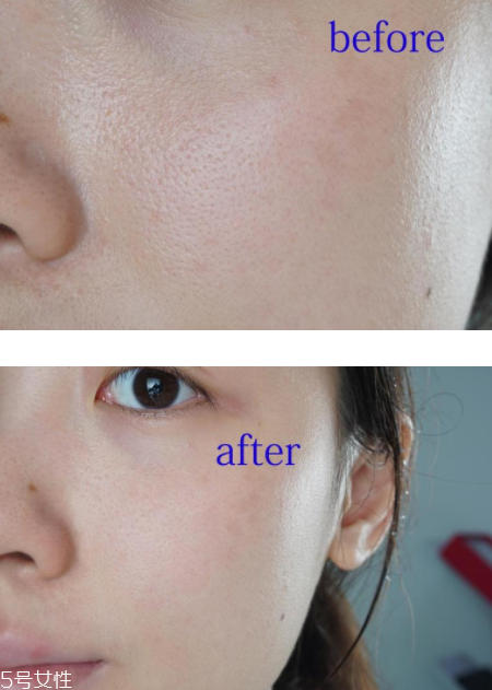 notime導(dǎo)入儀怎么樣？入門美容儀首選它