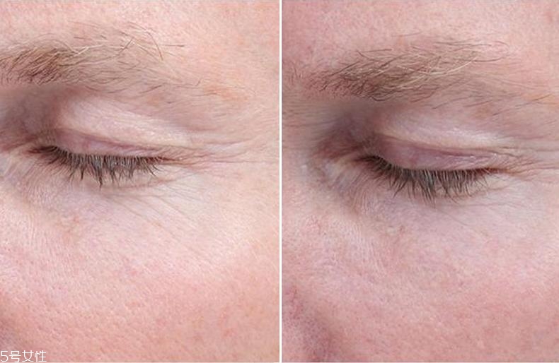 經(jīng)常熬夜用什么精華？3款實力派養(yǎng)出嫩膚新境界