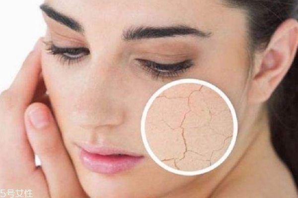 護膚水用了臉上刺痛怎么回事？這3點是關(guān)鍵