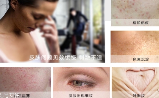 德國(guó)krauterhof蝸牛精華膏效果怎么樣？