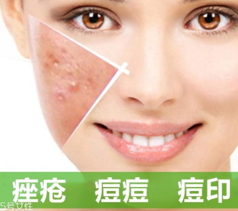 a酸怎么用？a酸怎么建立耐受？