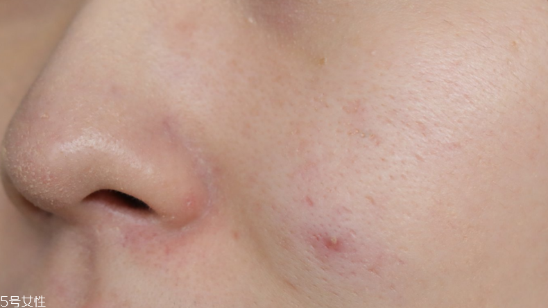 蘭蔻氣墊素顏霜怎么樣？遮瑕度不夠