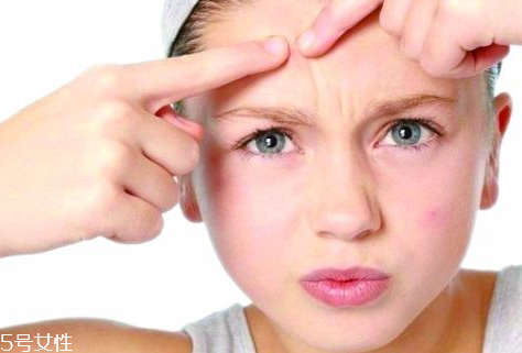 skinb5抗痘護膚片有效果嗎？