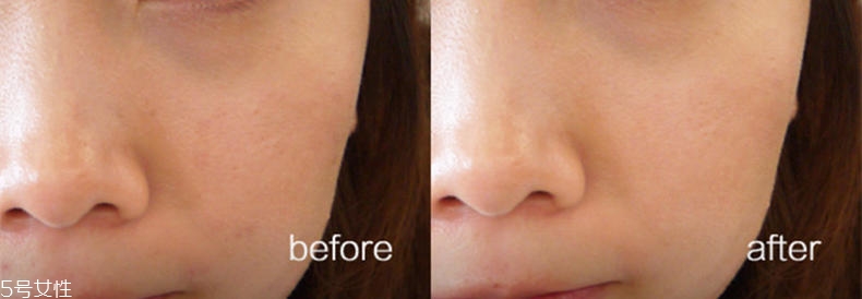 悅詩風(fēng)吟慕斯清潔面膜溫和嗎？干皮慎用