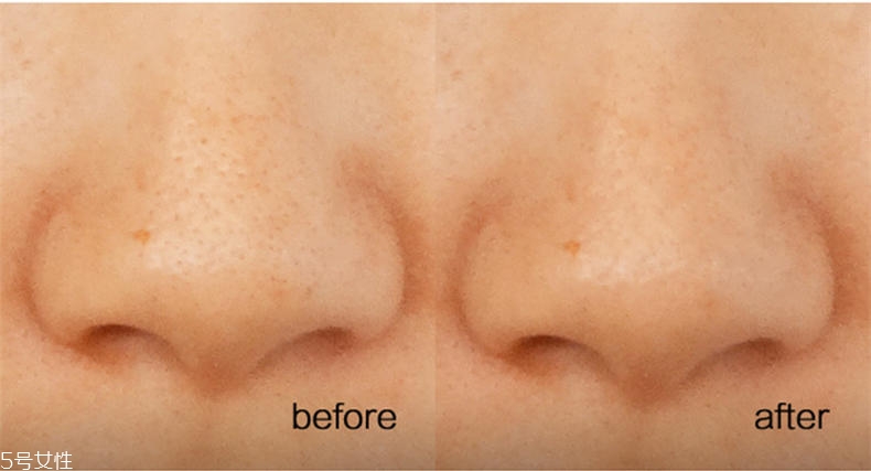 悅詩風(fēng)吟慕斯清潔面膜溫和嗎？干皮慎用