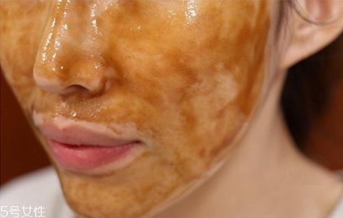 夏天油皮不能敷哪種面膜？這三種面膜越敷越油