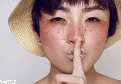 祛斑反彈是什么原因？一定沒注意這4點(diǎn)