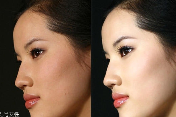 23歲應(yīng)該怎么護膚？不注意這3點你比閨蜜還顯老