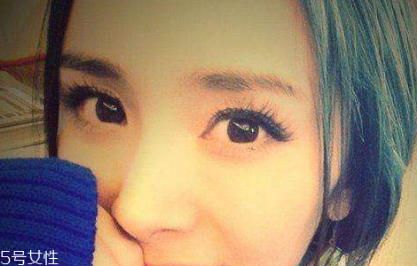 葉黃素能治白內(nèi)障嗎？有一定改善作用