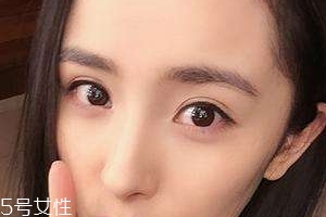 葉黃素能治療夜盲癥嗎？看什么類型的