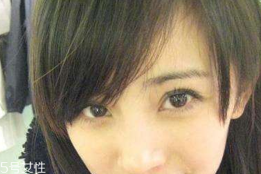 葉黃素能治療夜盲癥嗎？看什么類型的