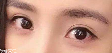 葉黃素能治療夜盲癥嗎？看什么類型的