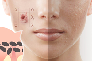 去角質(zhì)啫喱多久用一次？