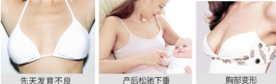 豐胸霜怎么用？豐胸霜使用手法詳解