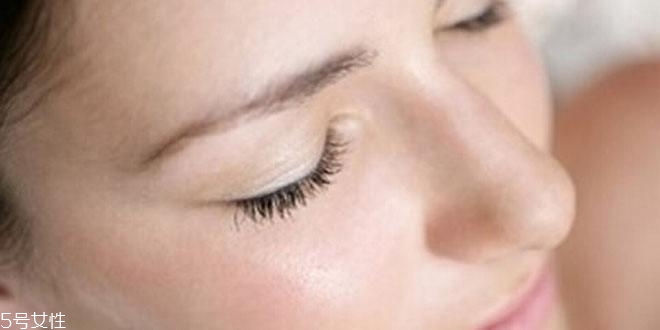 皮膚出油是因?yàn)轵x嗎 臉上有螨蟲的征兆 皮膚出油是因?yàn)轵x嗎 臉上有螨蟲的征兆