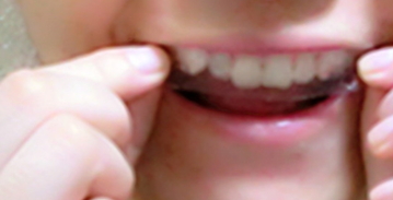 牙貼使用方法 牙貼使用注意事項(xiàng) 牙貼使用方法 牙貼使用注意事項(xiàng)