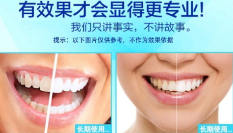 美白牙貼會反彈嗎？牙貼美白效果持續(xù)多久