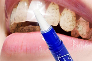 mistine美牙筆怎么用？mistine美牙筆評測