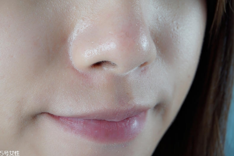 泊舒清痘霜有用嗎 泊舒清痘能力實測 泊舒清痘霜有用嗎 泊舒清痘能力實測