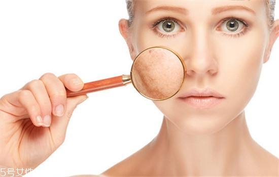 干性皮膚有幾種？8種干皮類型的護(hù)膚策略