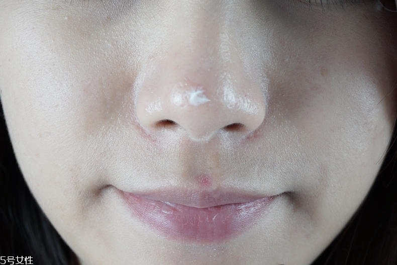 泊舒清痘霜有用嗎 泊舒清痘能力實測 泊舒清痘霜有用嗎 泊舒清痘能力實測