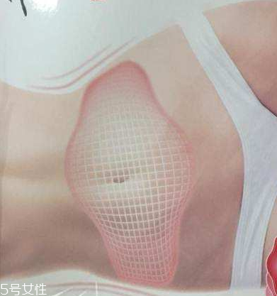 瘦身貼什么時(shí)候用最好？瘦身貼最佳使用時(shí)間