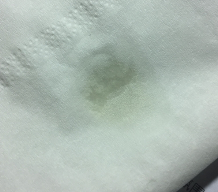 天竺葵精油可以去黑頭嗎？天竺葵精油怎么去黑頭