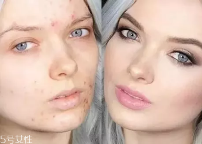 哪種粉底適合痘痘肌 痘痘肌粉底液 哪種粉底適合痘痘肌 痘痘肌粉底液