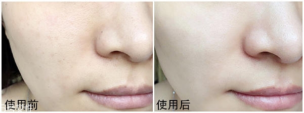 fab修復(fù)面霜有依賴性嗎 fab急救面霜有副作用嗎 fab修復(fù)面霜有依賴性嗎 fab急救面霜有副作用嗎