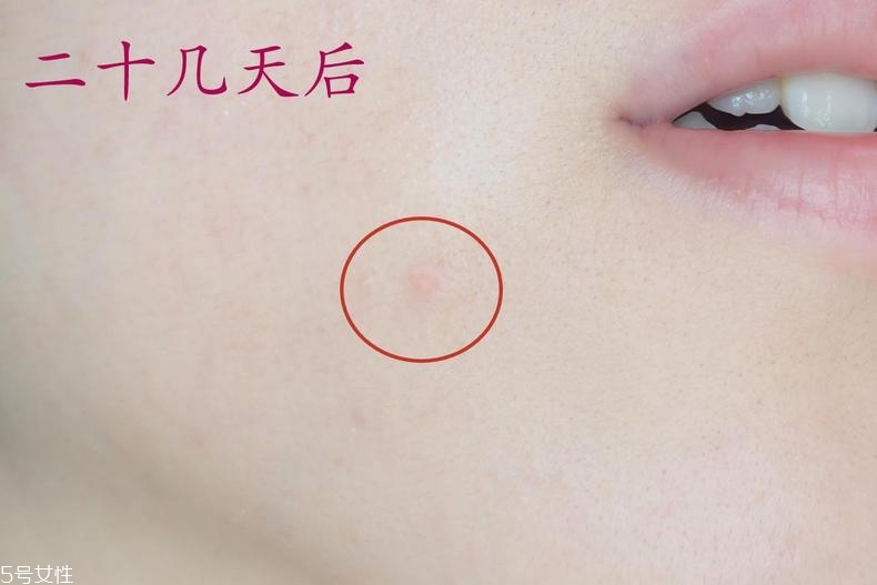 雅詩蘭黛晶透沁白防曬搖搖乳成膜快嗎？適合油痘皮嗎？