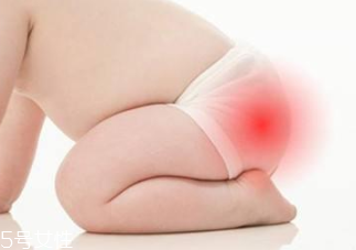 濕疹能穿紙尿褲嗎 紙尿褲會影響生育嗎 濕疹能穿紙尿褲嗎 紙尿褲會影響生育嗎