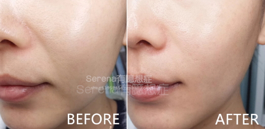 dermawand逆齡射頻注氧棒怎么用？