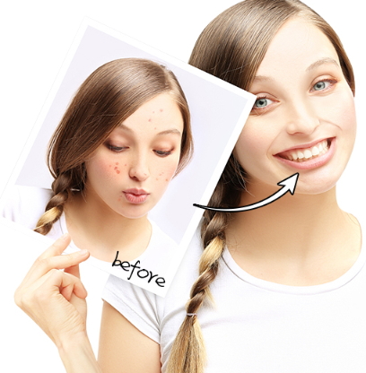 導(dǎo)出儀器真的有用嗎？導(dǎo)出儀的功效