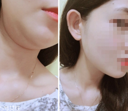 dodo label隱形瘦臉貼好用嗎 韓國(guó)ins網(wǎng)紅爆款瘦臉神器 dodo label隱形瘦臉貼好用嗎 韓國(guó)ins網(wǎng)紅爆款瘦臉神器