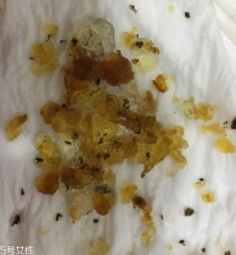 桃膠能和雞蛋一起吃嗎？桃膠配雞蛋可以嗎？