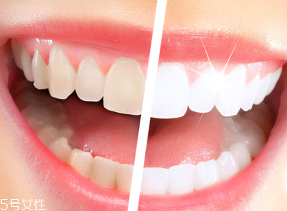 便宜牙膏和貴牙膏有什么不同 牙膏種類介紹 便宜牙膏和貴牙膏有什么不同 牙膏種類介紹