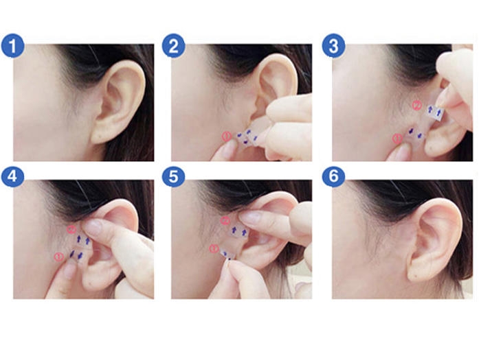 dodo label小顏膠布能用在身體上嗎?能瘦大腿嗎? dodo label小顏膠布能用在身體上嗎?能瘦大腿嗎?