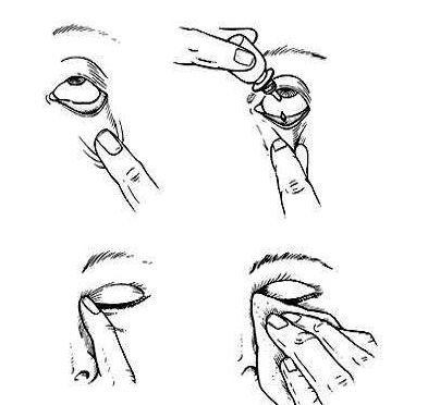 眼藥水兒童可以用嗎？眼藥水適合兒童用嗎？