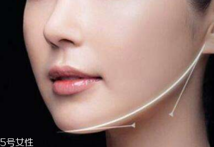 粉毒瘦臉針能維持多久？粉毒瘦臉針能保持多長時(shí)間